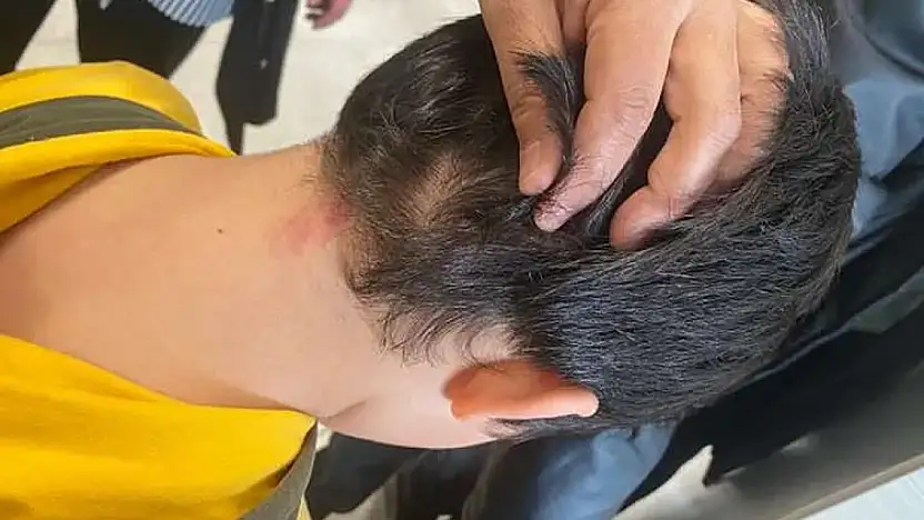 Konya'da veli dehşeti: 8 yaşındaki çocukları dövdükleri fırça sapı 'silah' sayıldı!