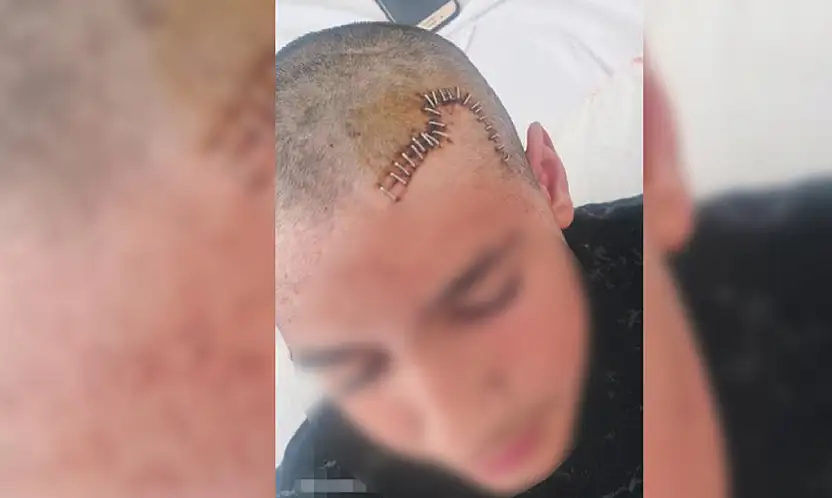 Konya'da arkadaşının kafatasını parçalayan çocuk ile ilgili flaş karar!